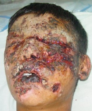 same face after surgery.